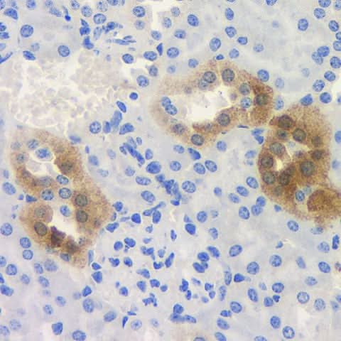 Immunohistochemistry analysis of paraffin-embedded mouse kidney using ROCK1 Polyclonal Antibody at dilution of 1:300.