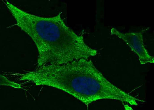 Anti-Human GSTM2 Antibody [B165] - ABMIUM