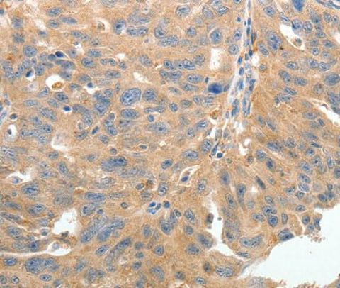 Anti-Human TERT Antibody - ABMIUM