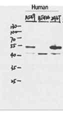 Anti-Human/Mouse/Rat P53 Antibody