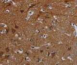 Anti-Human PCDHB15 Antibody - ABMIUM
