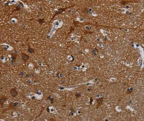 Anti-Human PCDHB15 Antibody