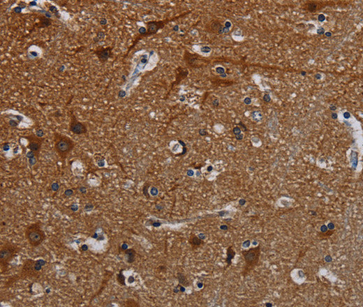 Anti-Human PCDHB15 Antibody - ABMIUM
