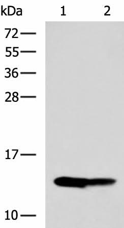 Western blot analysis of Mouse liver tissue and Mouse kidney tissue lysates using RIDA Polyclonal Antibody at dilution of 1:650