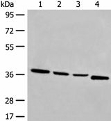 Anti-Human/Mouse OTUD6A Antibody - ABMIUM