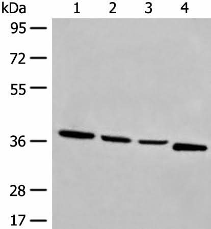 Anti-Human/Mouse OTUD6A Antibody - ABMIUM