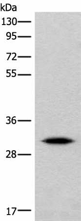 Western blot analysis of Human cerebrum tissue lysate using IMPA1 Polyclonal Antibody at dilution of 1:360