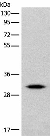Western blot analysis of Human cerebrum tissue lysate using IMPA1 Polyclonal Antibody at dilution of 1:360