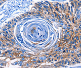 Anti-Human CLEC2B Antibody - ABMIUM