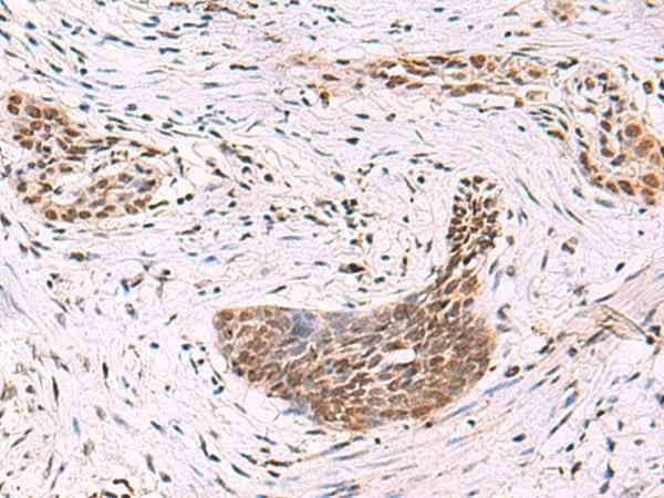 Anti-Human/Mouse/Rat CREBBP Antibody