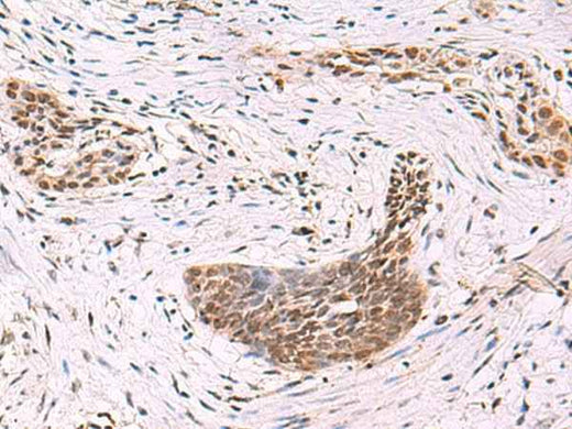 Anti-Human/Mouse/Rat CREBBP Antibody