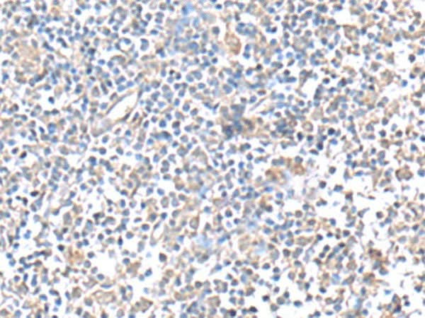 Immunohistochemistry of paraffin-embedded Human tonsil tissue using IFI27 Polyclonal Antibody at dilution of 1:80(×200)