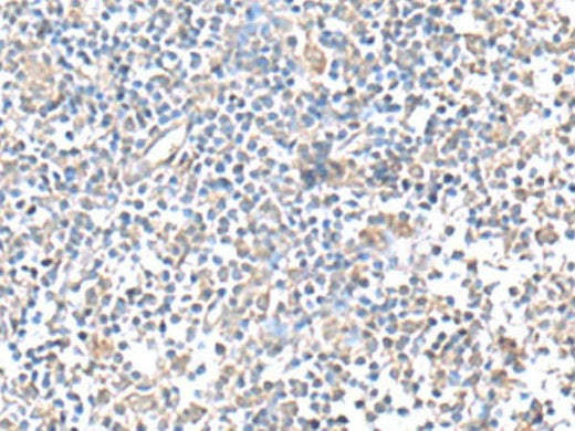 Immunohistochemistry of paraffin-embedded Human tonsil tissue using IFI27 Polyclonal Antibody at dilution of 1:80(×200)