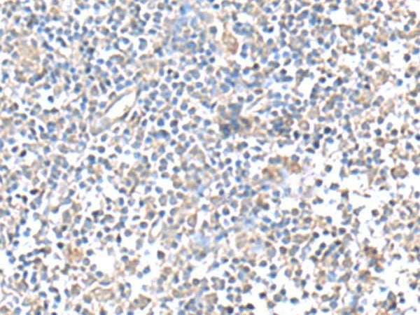 Immunohistochemistry of paraffin-embedded Human tonsil tissue using IFI27 Polyclonal Antibody at dilution of 1:80(×200)
