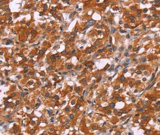 Anti-Human/Mouse/Rat HSPB6 Antibody