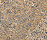 Anti-Human/Mouse PRDM14 Antibody - ABMIUM
