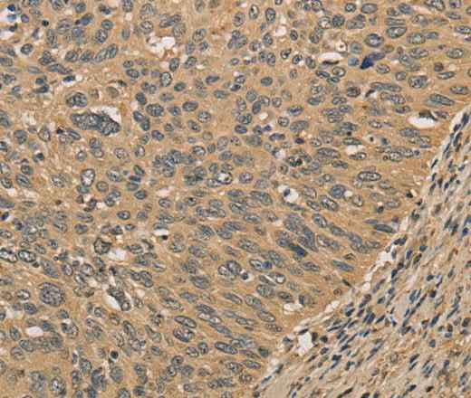 Anti-Human/Mouse PRDM14 Antibody