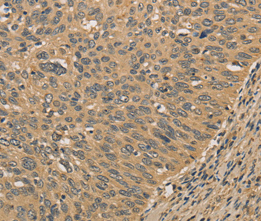 Anti-Human/Mouse PRDM14 Antibody - ABMIUM