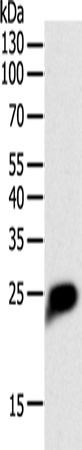 Anti-Human CRP Antibody - ABMIUM