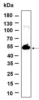 Anti-Human/Mouse TMEM161B Antibody [B968]