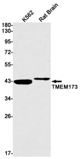 Western blot detection of TMEM173 in K562,Rat Brain lysates using TMEM173 Rabbit mAb(1:1000 diluted).Predicted band size:42kDa.Observed band size:40kDa.
