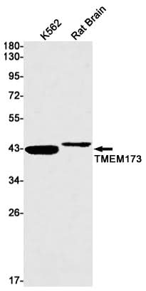 Western blot detection of TMEM173 in K562,Rat Brain lysates using TMEM173 Rabbit mAb(1:1000 diluted).Predicted band size:42kDa.Observed band size:40kDa.