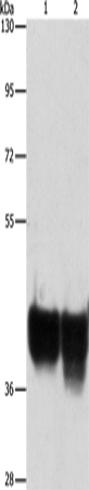 Anti-Human/Mouse/Rat AUP1 Antibody - ABMIUM