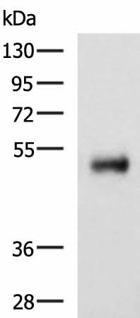 Western blot analysis of Human colorectal cancer tissue lysate using METTL17 Polyclonal Antibody at dilution of 1:800