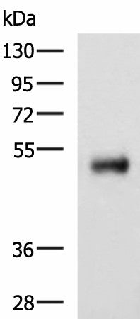 Western blot analysis of Human colorectal cancer tissue lysate using METTL17 Polyclonal Antibody at dilution of 1:800