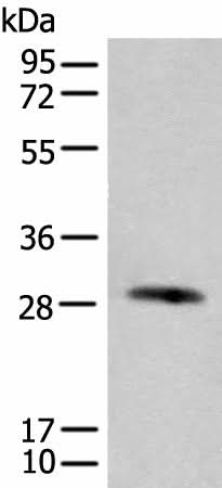 Western blot analysis of Human urinary bladder tissue lysate using CFHR2 Polyclonal Antibody at dilution of 1:550