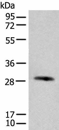 Western blot analysis of Human urinary bladder tissue lysate using CFHR2 Polyclonal Antibody at dilution of 1:550