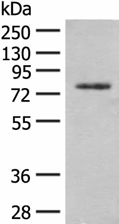 Western blot analysis of Hela cell lysate using TRMT1 Polyclonal Antibody at dilution of 1:300