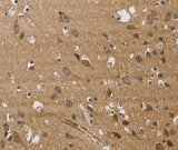 Anti-Human/Mouse/Rat JAG1 Antibody - ABMIUM