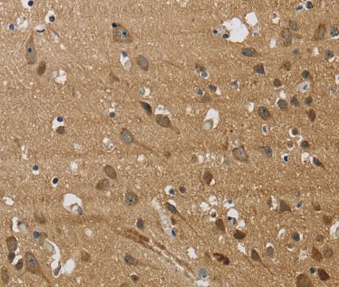 Anti-Human/Mouse/Rat JAG1 Antibody - ABMIUM
