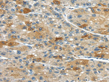 Anti-Human/Mouse UPP2 Antibody - ABMIUM