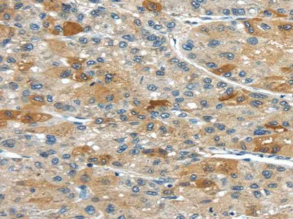 Anti-Human/Mouse UPP2 Antibody