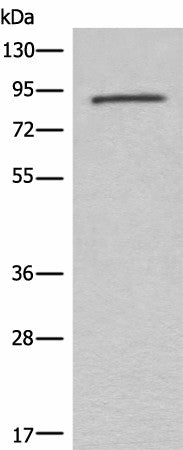 Western blot analysis of Mouse lung tissue lysate using C7 Polyclonal Antibody at dilution of 1:800