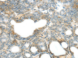 Anti-Human/Mouse SERPINB11 Antibody - ABMIUM