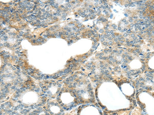 Anti-Human/Mouse SERPINB11 Antibody - ABMIUM