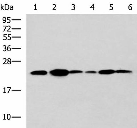 Western blot analysis of NIH/3T3 cell Mouse Pancreas tissue Rat lung tissue Mouse liver tissue Hela Raji cell lysates using TMED10 Polyclonal Antibody at dilution of 1:900