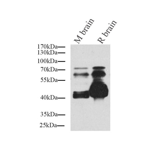 Western Blot analysis of various samples using Tau Polyclonal Antibody at dilution of 1:1000.