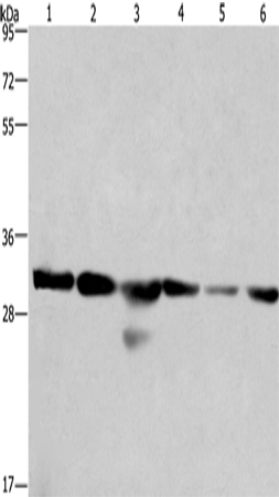 Anti-Human/Mouse/Rat PHB Antibody - ABMIUM