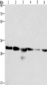 Anti-Human/Mouse/Rat PHB Antibody - ABMIUM