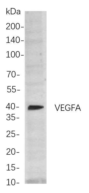 Anti-Human/Mouse/Rat/Pig/Rabbit VEGFA Antibody [B787] - ABMIUM