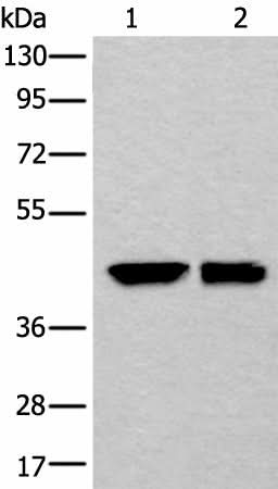 Western blot analysis of HEPG2 and 231 cell lysates using DLK1 Polyclonal Antibody at dilution of 1:250