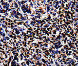 Anti-Human/Mouse/Rat S100A4 Antibody - ABMIUM