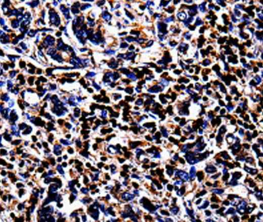 Anti-Human/Mouse/Rat S100A4 Antibody