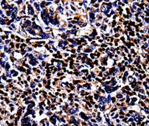 Anti-Human/Mouse/Rat S100A4 Antibody - ABMIUM
