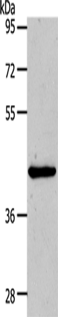 Anti-Human/Mouse/Rat MMP13 Antibody - ABMIUM