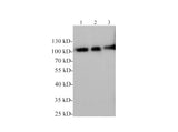 Western blotting with anti-ICAM-1 polyclonal antibody at dilution of 1:1000. Lane 1: Rat kidney lysate, Lane 2: Rat spleen lysate, lane 3: Rat liver lysate.